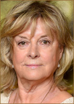   (Grynet Molvig) 
