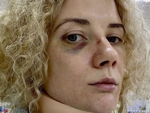 Актриса фильма «Стиляги» Инна Коляда заявила о жестком избиении